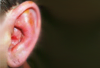 HIV-Positive Man With Painful Red Ear
