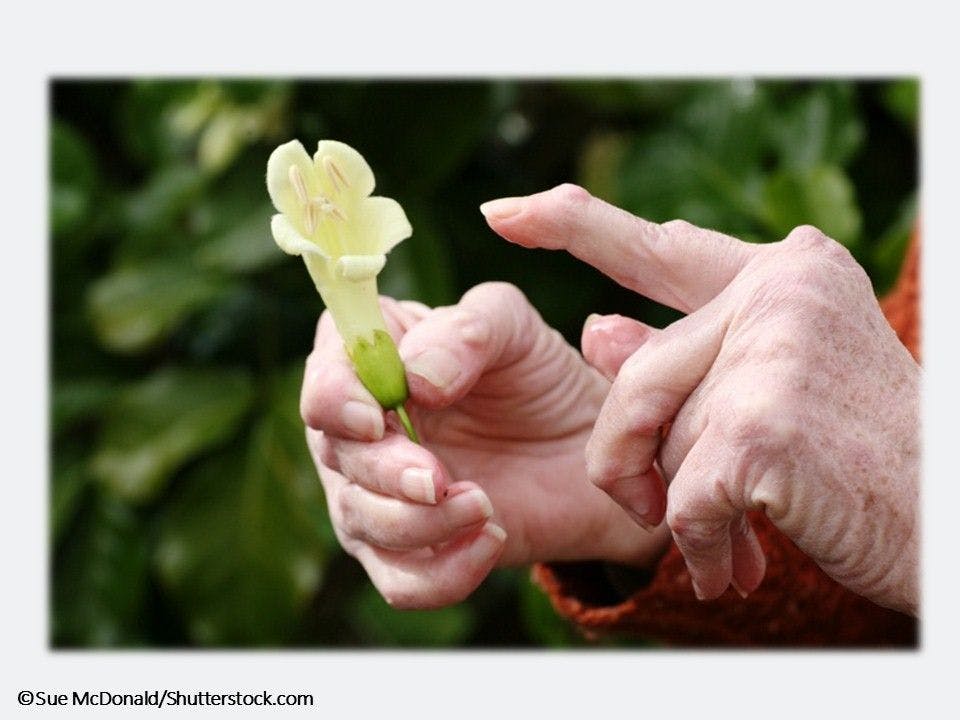 8 New Rheumatoid Arthritis Findings