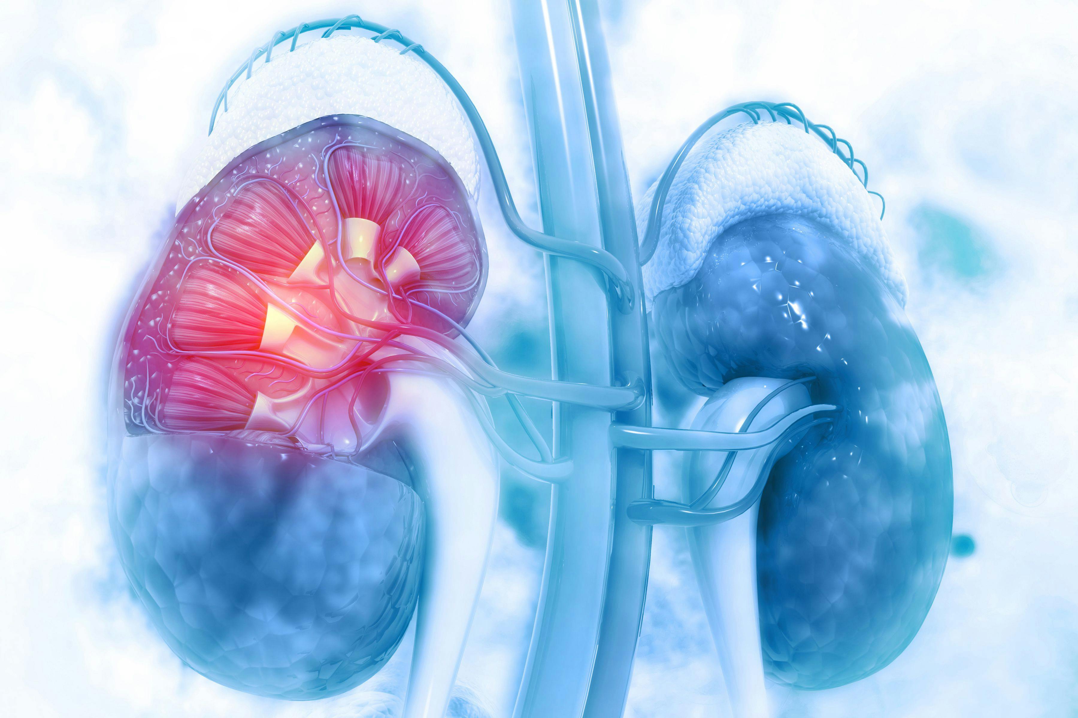 chronic kidney disease, primary care physicians, primary care, renal disease