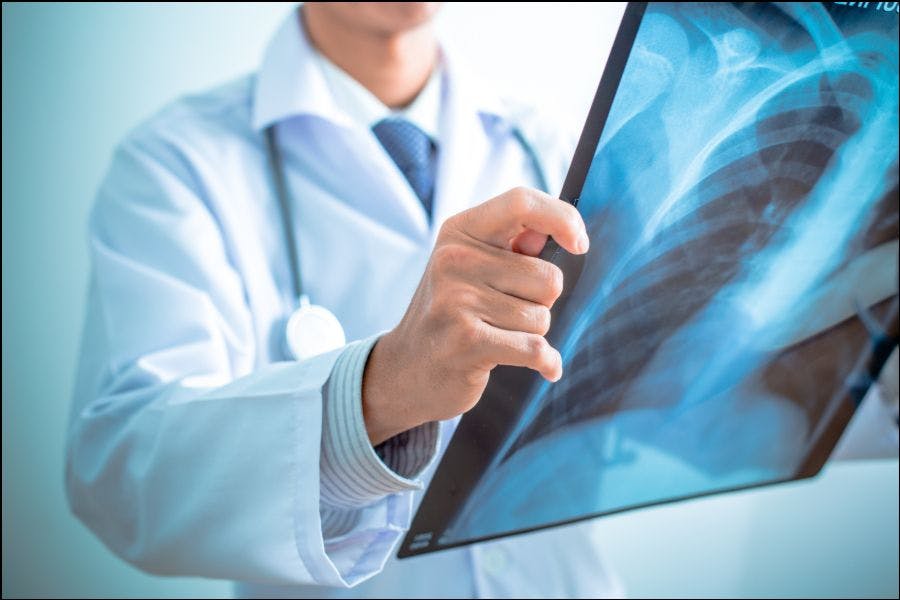 COPD Diagnosis in Primary Care: A Quick Quiz