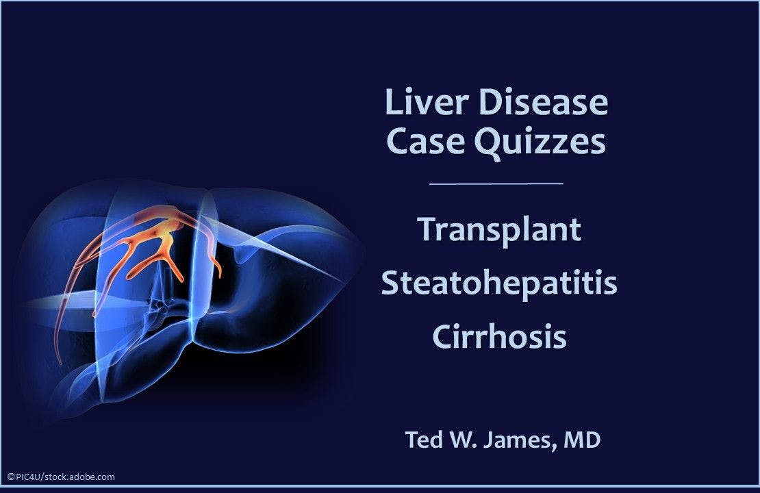 3 Liver Disease Case Challenges: Transplant, Steatohepatitis, Cirrhosis 
