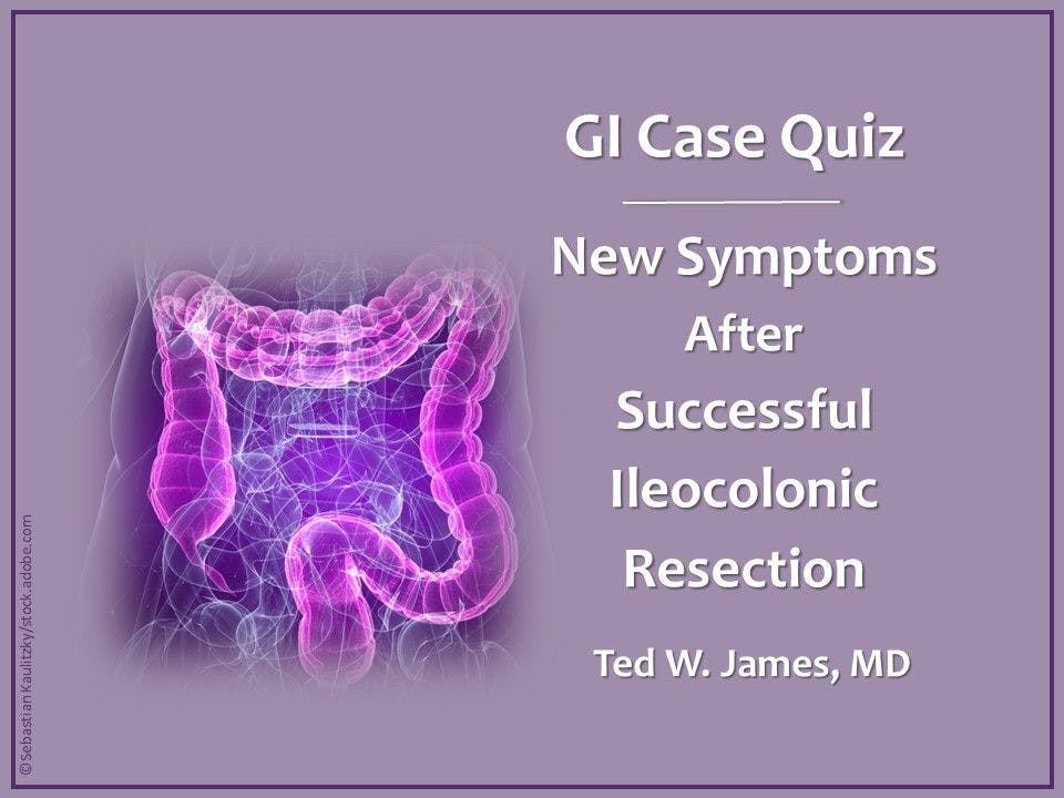 GI Case Quiz: Ileocolonic Anastomosis a Success, New Symptoms Arise 