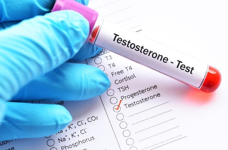 ©jarun011/Adobe Stock Testosterone Replacement Does Not Increase Risk for CV Events in Men with Hypogonadism, New Study Finds