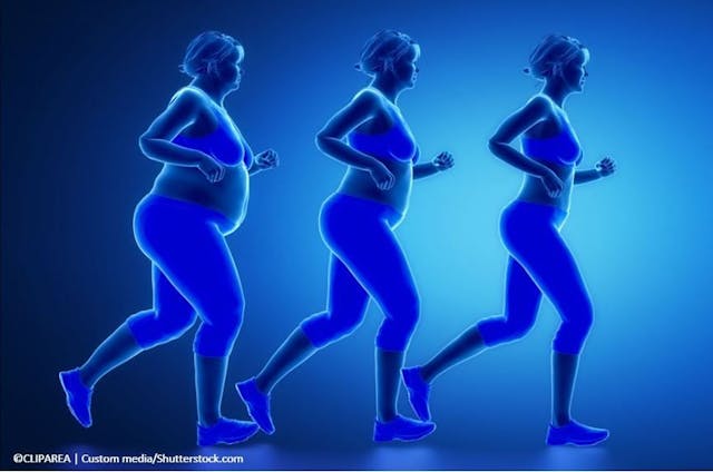 Optimal Cardioprotective BMI for Adults with Type 2 Diabetes Could Vary by Age  / image credit weightloss: ©CLIPAREA/shutterstock.com