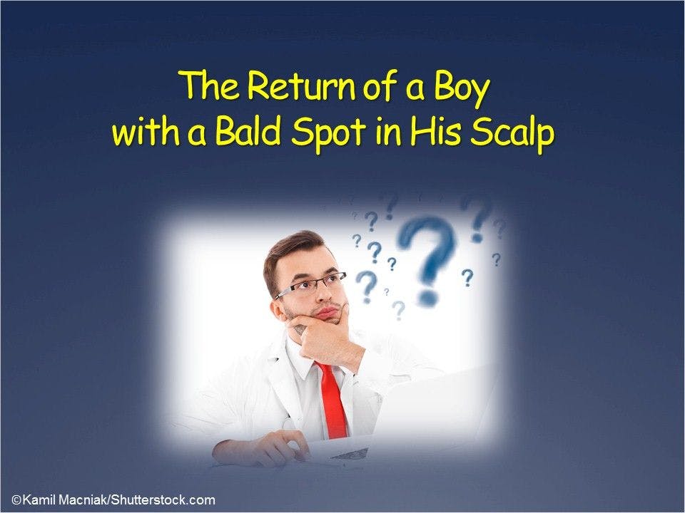 A Boy with a Bald Spot on his Scalp, Returns 