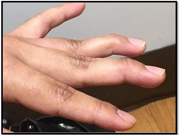 Funky Finger - What's Your Diagnosis? 