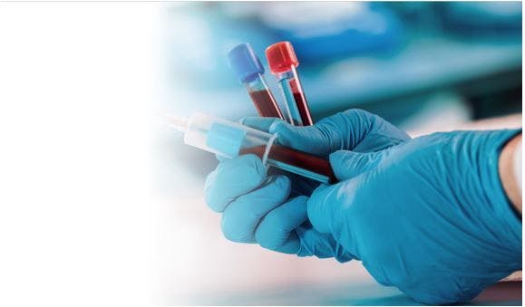 Novel Liquid Biopsy for NASH Determined Highly Accurate, Sensitive, Specific