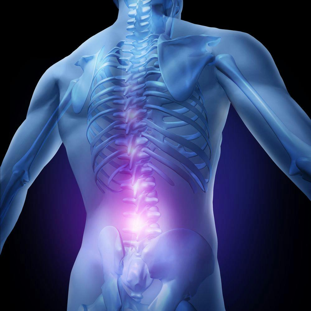 3 Questions You Need to Ask About Low Back Pain