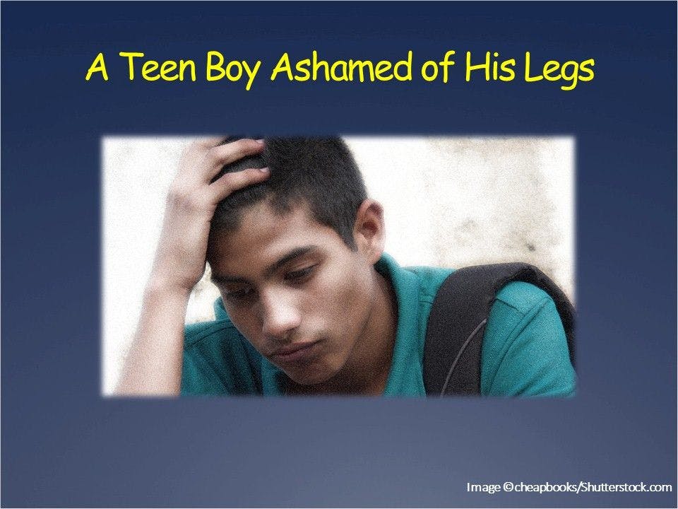 A Teenage Boy with Leg Shame 