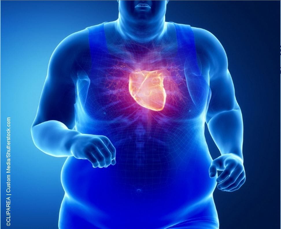 Overweight, Obesity Overlooked in Secondary CHD Prevention, Study Finds 