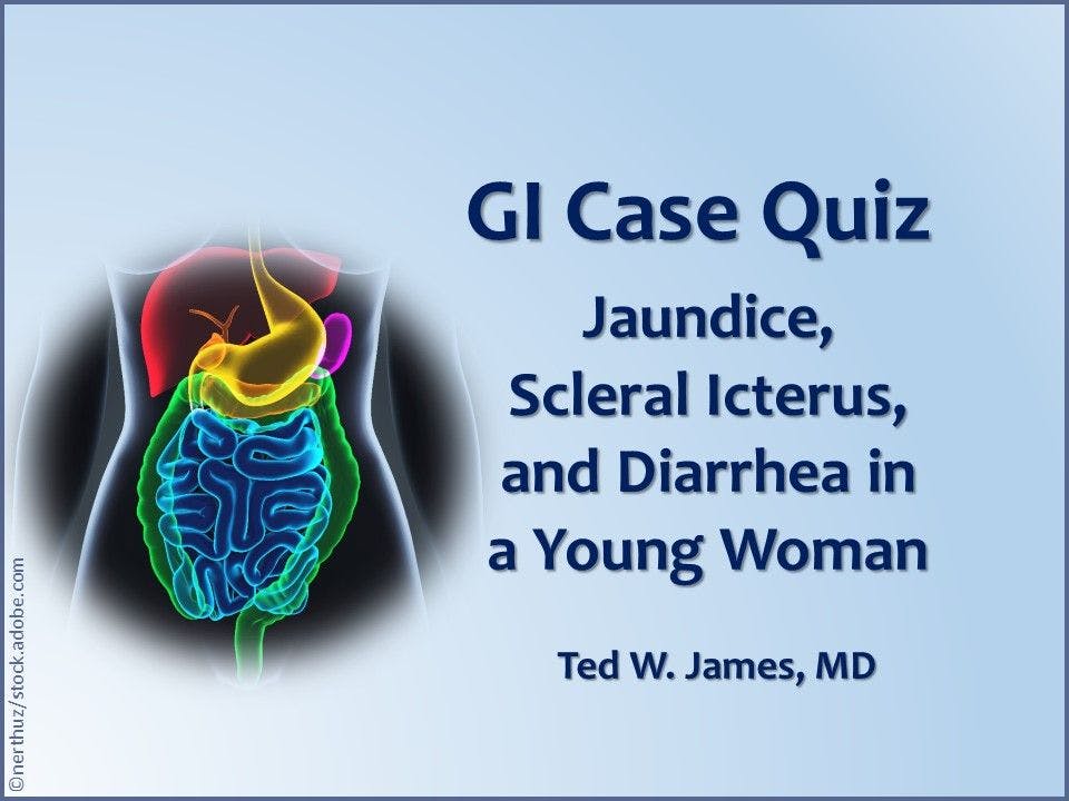 GI Case Quiz: Jaundice, Scleral Icterus, and Diarrhea in a Young Woman 