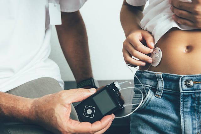Artificial Pancreas Improves Time in Range for Young Children with Type 1 Diabetes, According to New Study