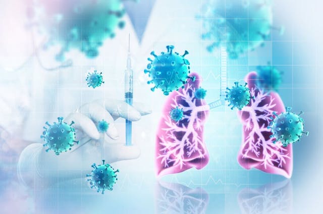 Hydrocortisone Bests Other Corticosteroids for Community-Acquired Pneumonia in New Analysis / Image credit: ©Crystal Light/AdobeStock