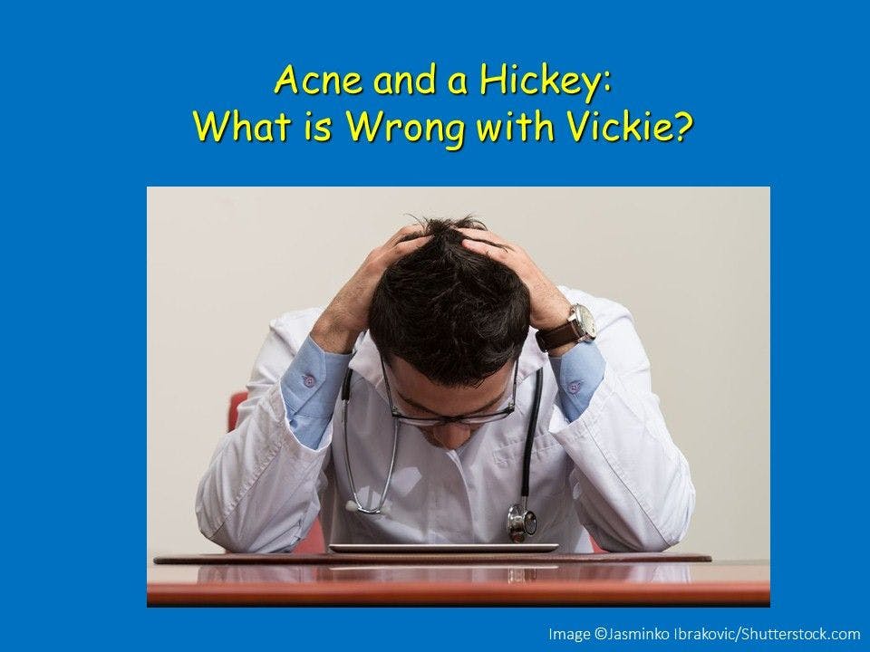 Acne and a Hickey: What is Wrong with Vickie?