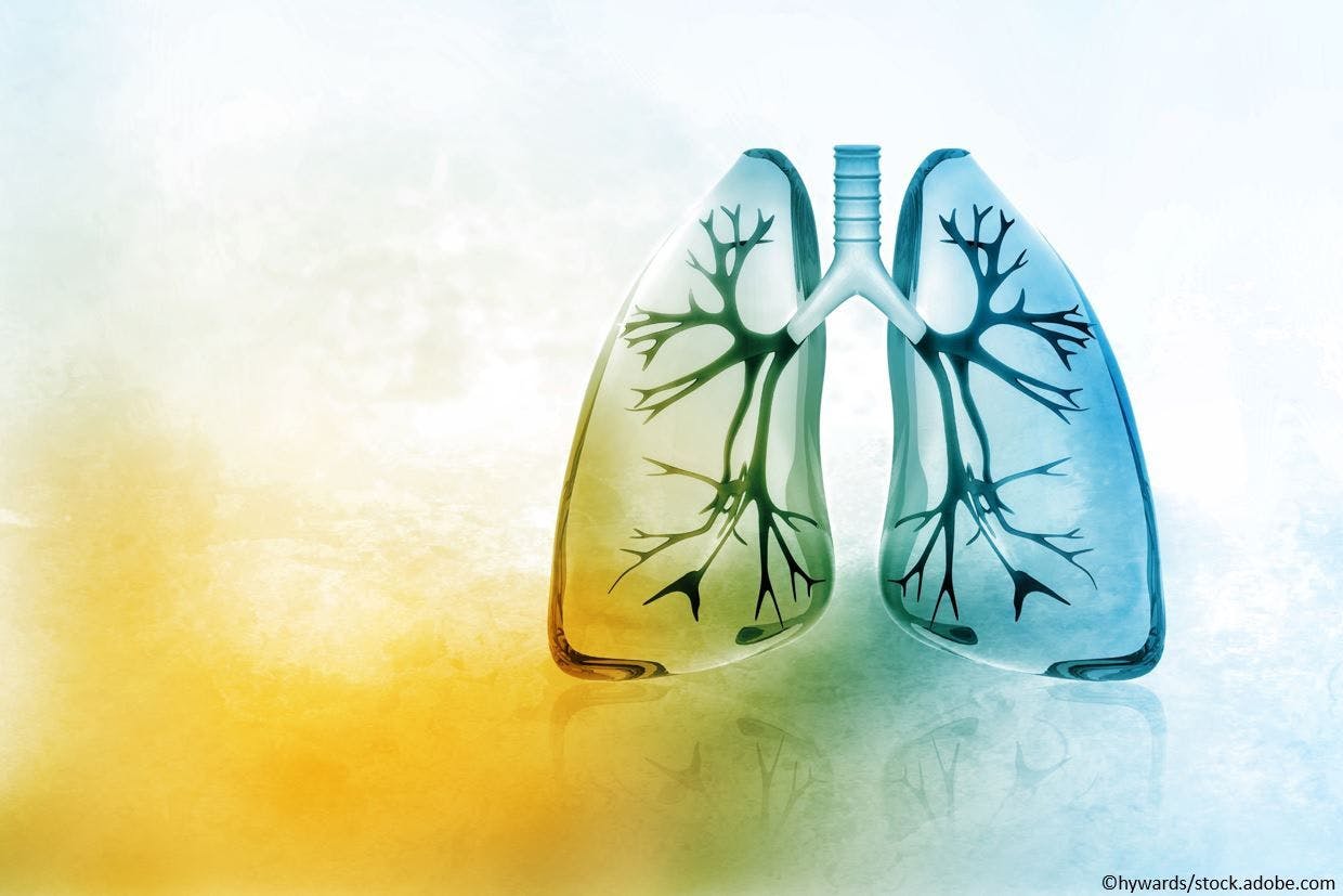 Pulmonary Rehab Improves Lung Function, QOL in Asthma-COPD Overlap Plus Obesity