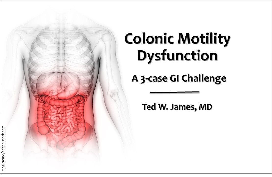 Colonic Motility Dysfunction: 3 Cases on Cause, Effects, Treatment 