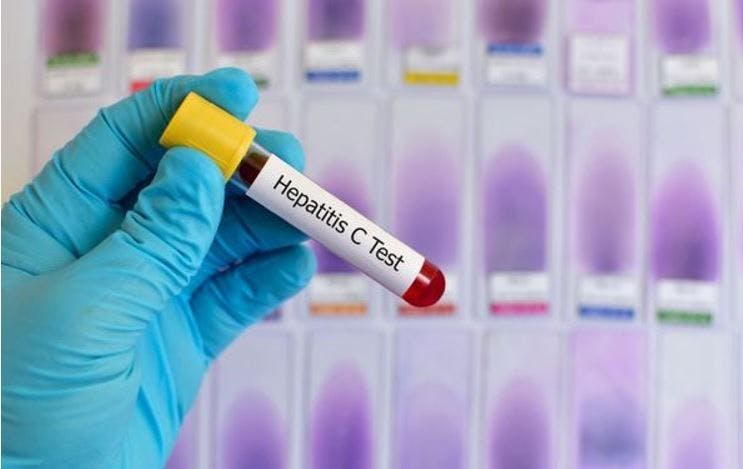 CDC Updates HCV Testing / image credit HCV test ©Jarun Ontakara/Shutterstock.com