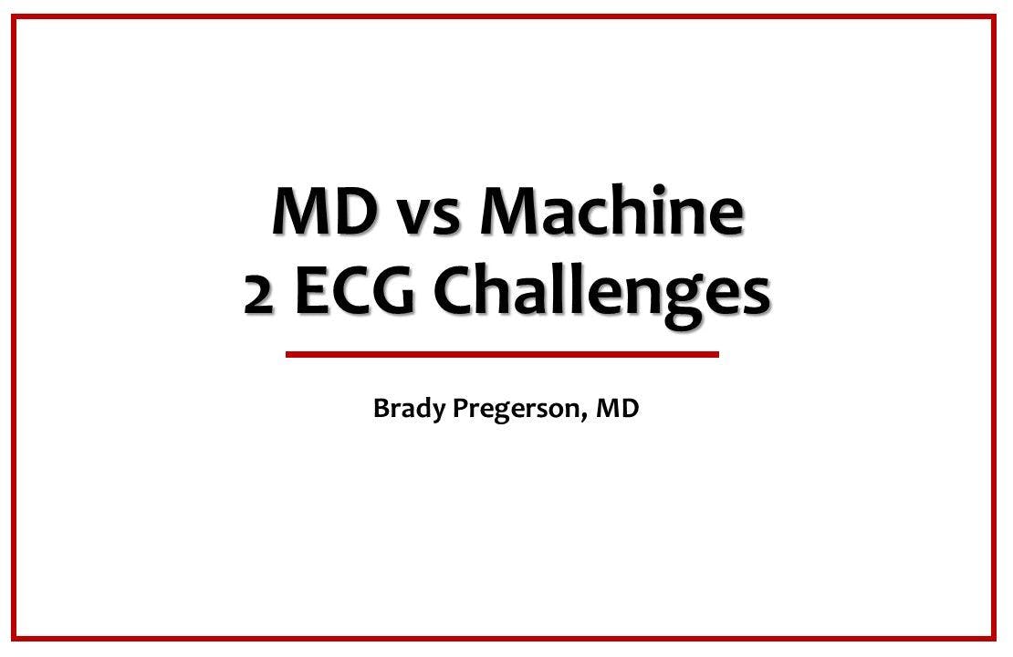 MD vs Machine: 2 ECG Challenges 