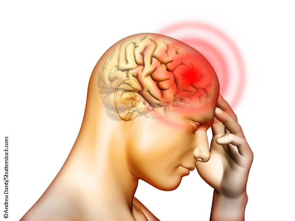 Get On Top of Headaches: 10 New Findings