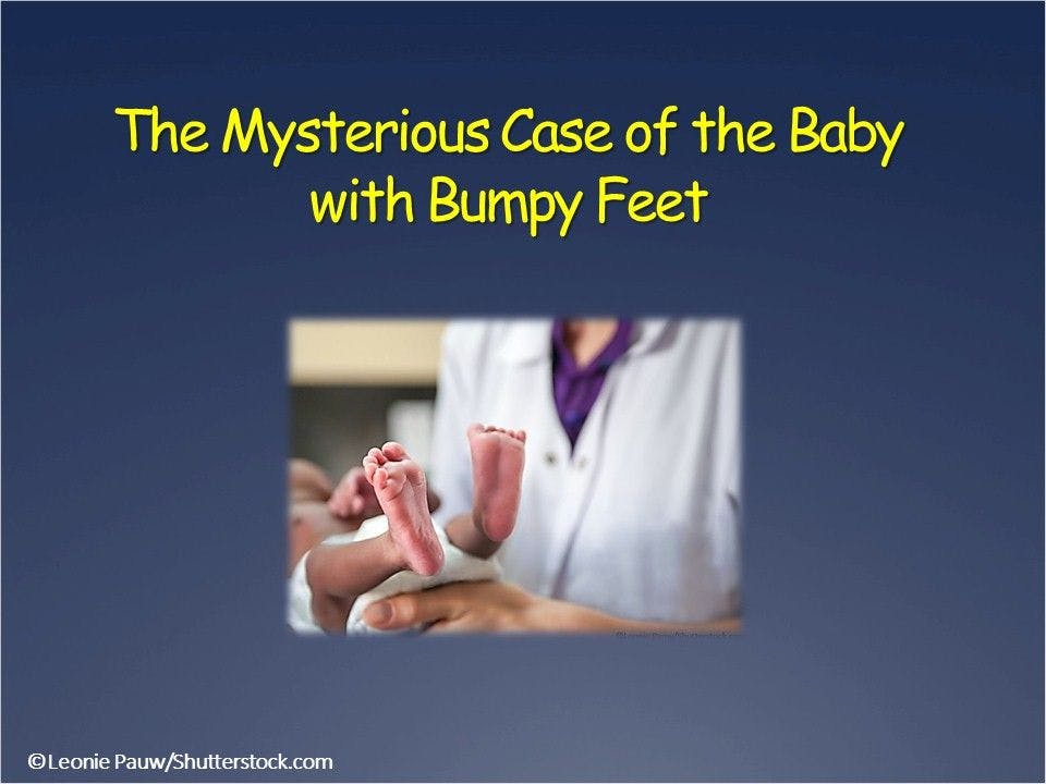 A Case of A Baby with Bumpy Feet 