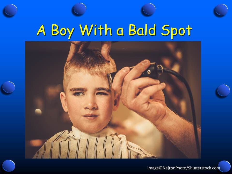 A Boy with a Bald Spot 