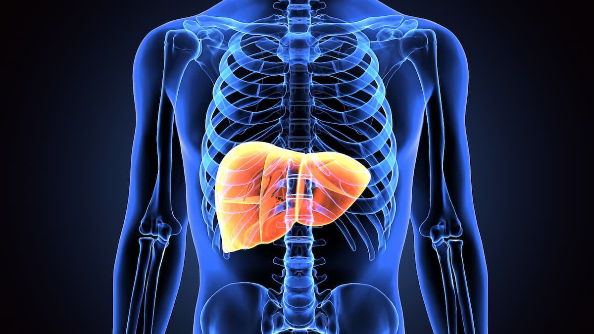 Real-world Study Suggests Need for Earlier Diagnosis of Non-alcoholic Steatohepatitis