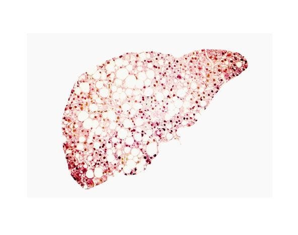 Hepatic Steatosis is a Risk Factor for MACE, Even Among Individuals at Low 10-Year ASCVD RisK / image credit liver  © Kateryna_Kon/stock.adobe.com
