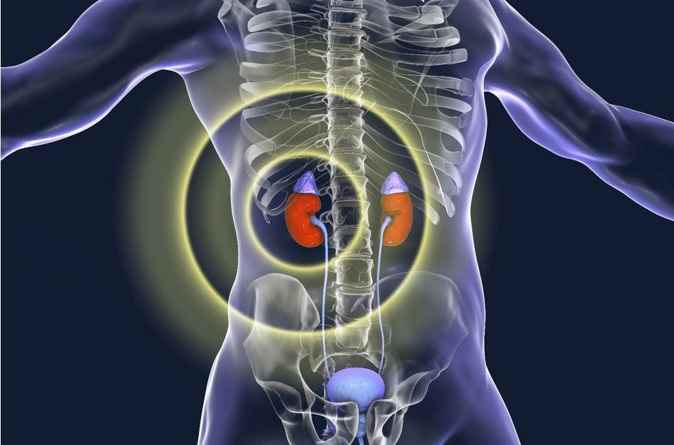 6 Questions on Chronic Kidney Disease: The Basics 
