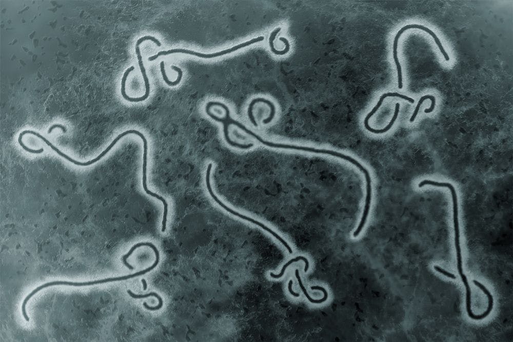  Ebola: 5 Things You Need to Know Now