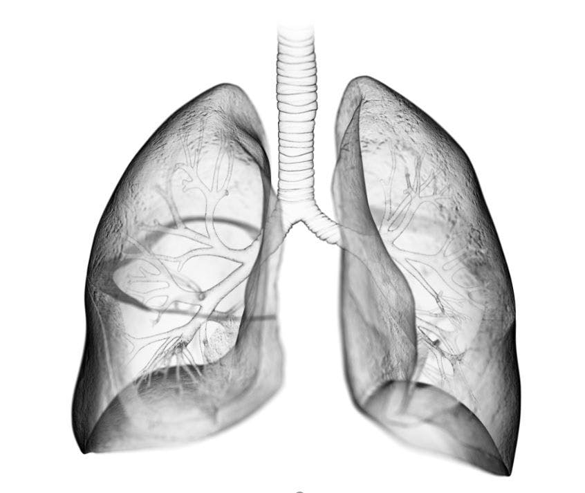 Guideline-directed cystic fibrosis treatment Sebastian Kaulitzki 