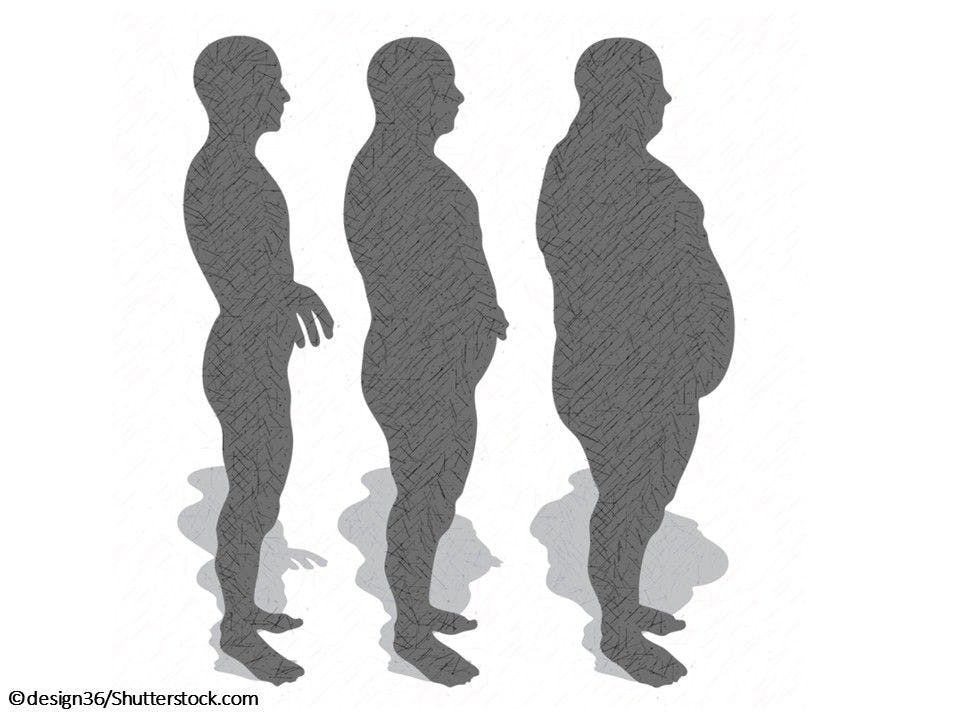 Research Weighs in on Obesity: 8 New Studies 