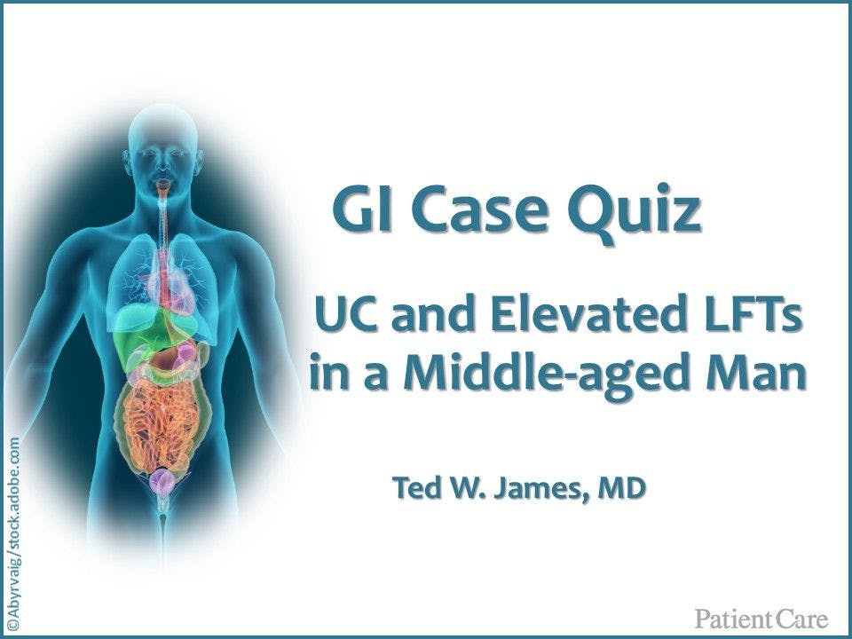 GI Case Quiz: Inactive UC and Elevated LFTs in a Middle-aged Man