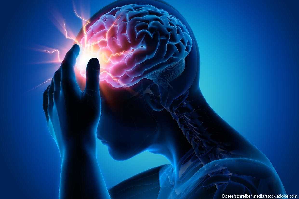 Consider CGRP Inhibitors as a First-Line Option for Preventive Treatment of Migraine: New American Headache Society Consensus Statement / image credit - headache: ©peterschreiber.media/stock.adobe.com