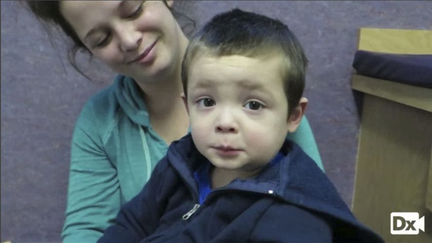 3-Year-Old Boy With Unilateral Facial Swelling 