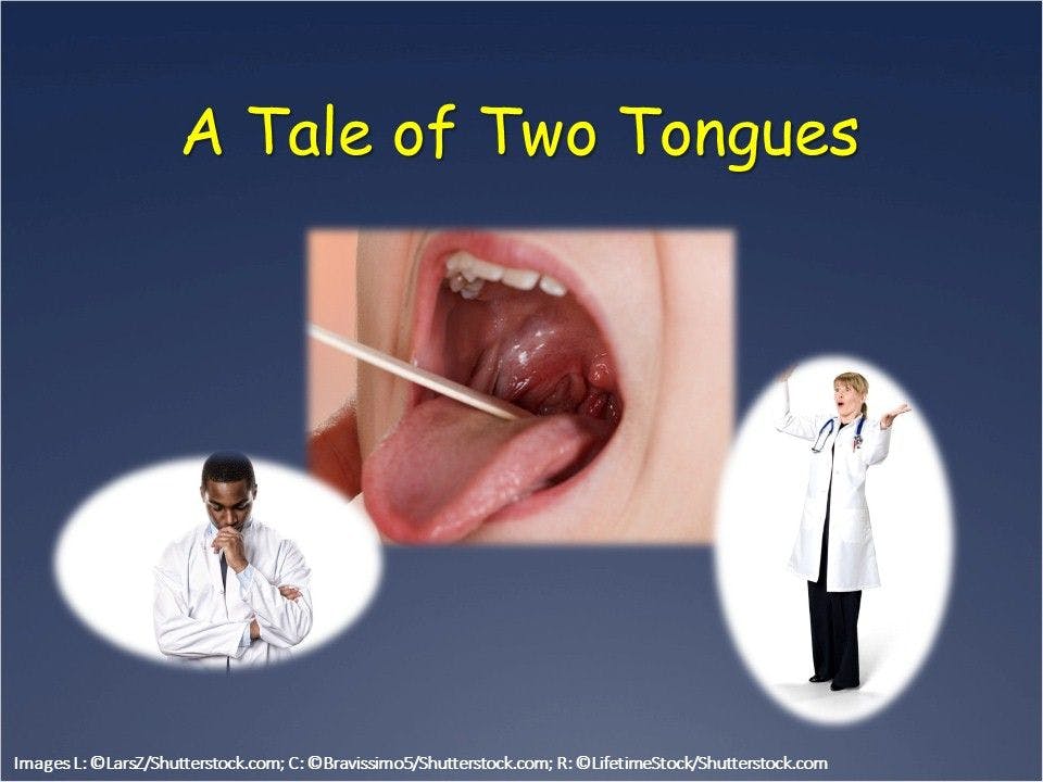 A Tale of Two Tongues