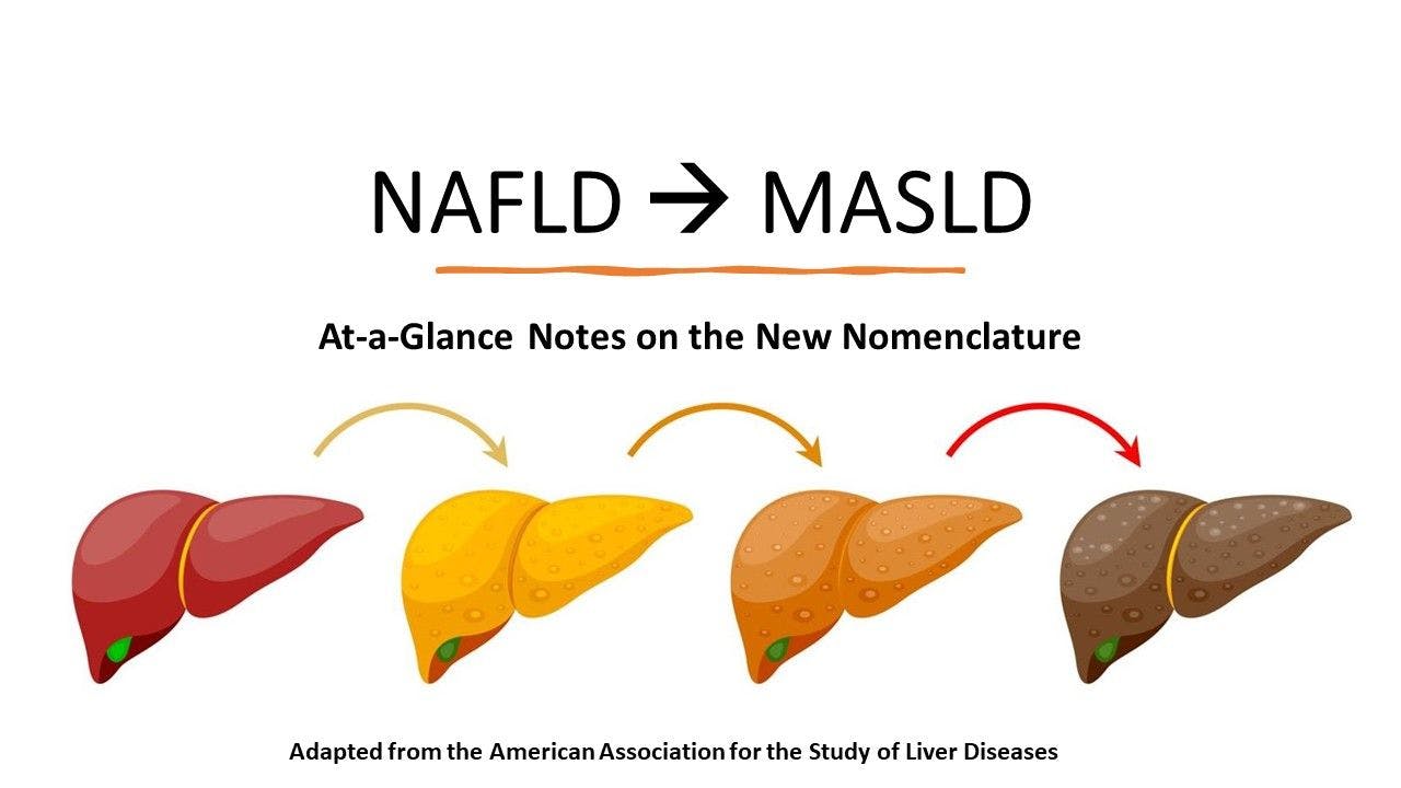 NAFLD is now MASLD: The new nomenclature at a glance / image credit - ©wowow/stock.adobe.com
