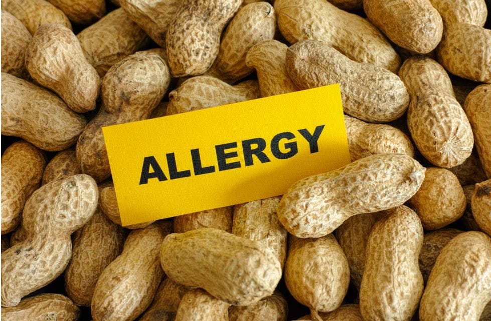 First Study of Oral Mucosal Immunotherapy for Peanut Allergy Elicits Robust Immunologic Response in Adults / image credit: peanut allergy: Stepan Popov/stock.adobe.com