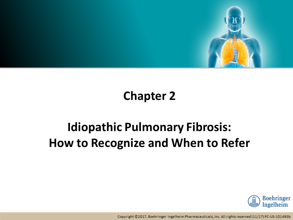 Idiopathic Pulmonary Fibrosis: How to Recognize and When to Refer