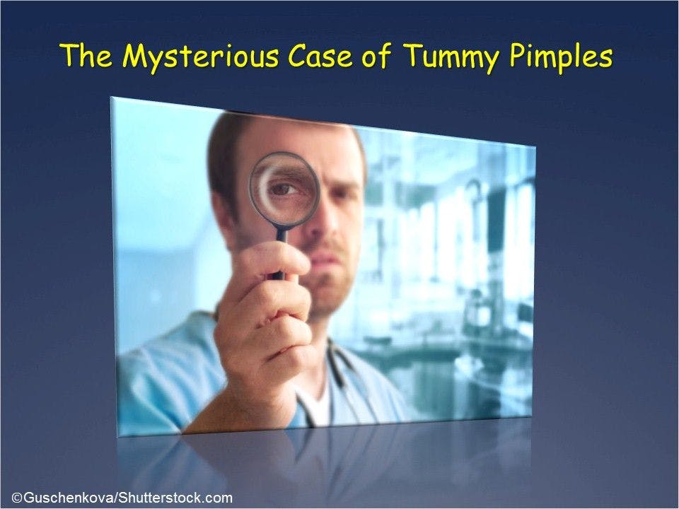 A Mysterious Case of Tummy Pimples 