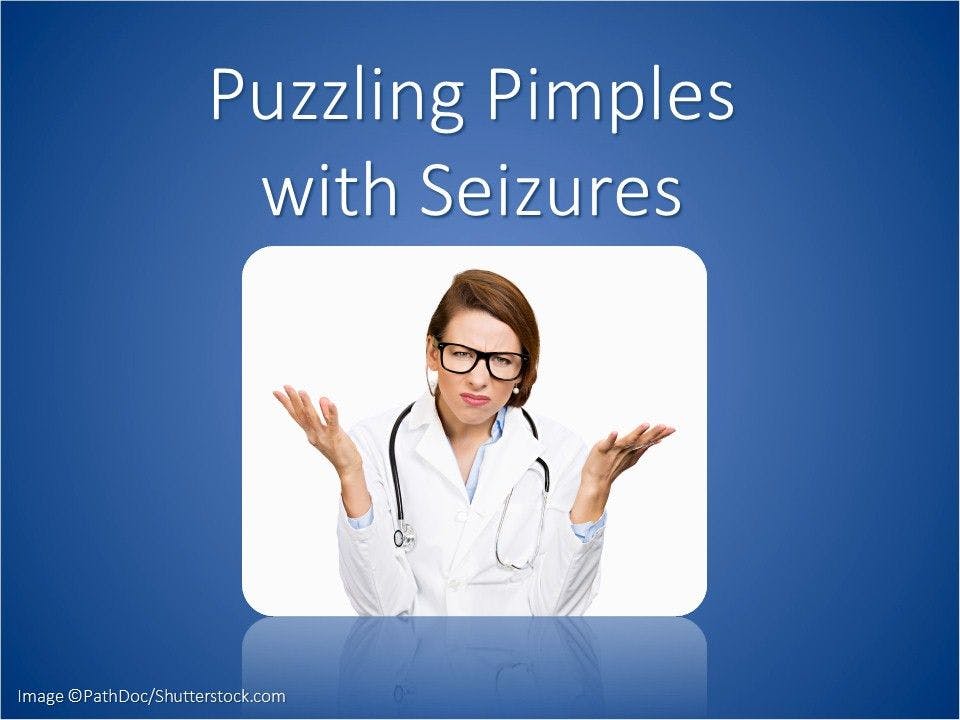 Pimples, Macules, and Seizure Disorder in a Young Family 