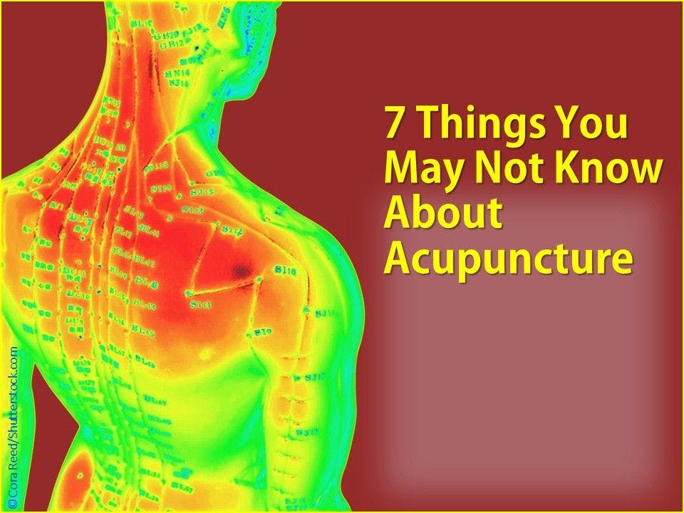 7 Things About Acupuncture You May Not Know 