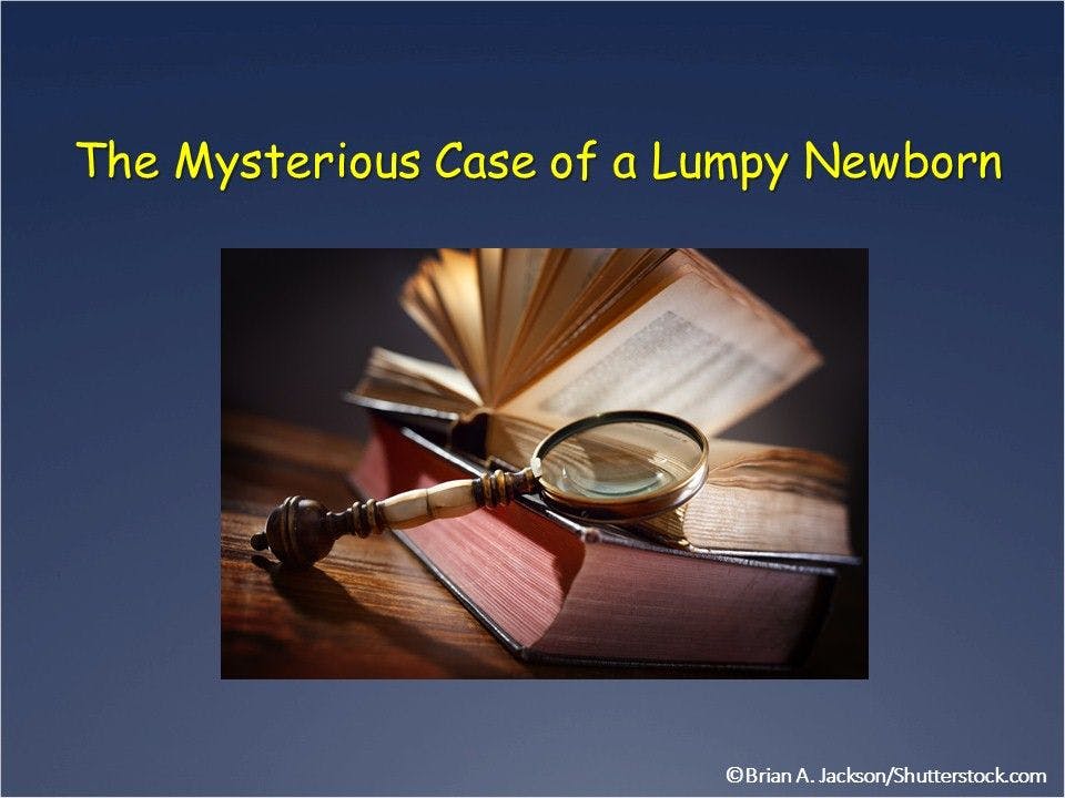 The Mysterious Case of a Lumpy Newborn 