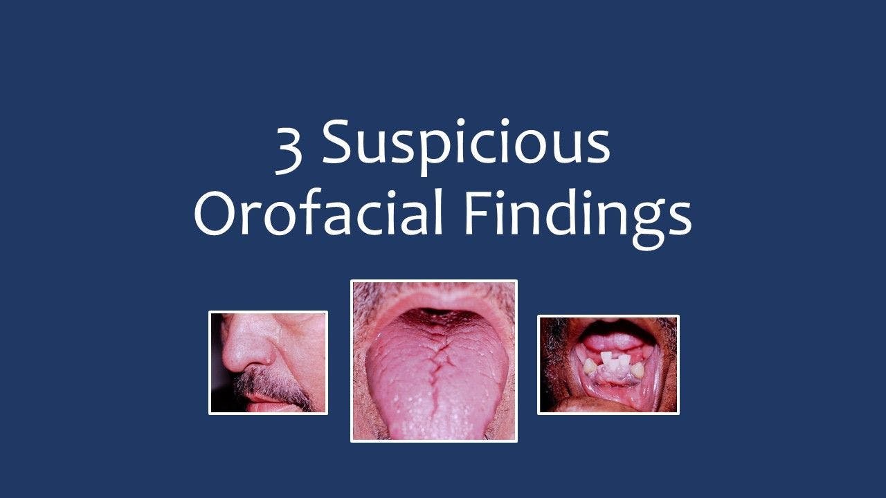 3 Suspicious Orofacial Findings 