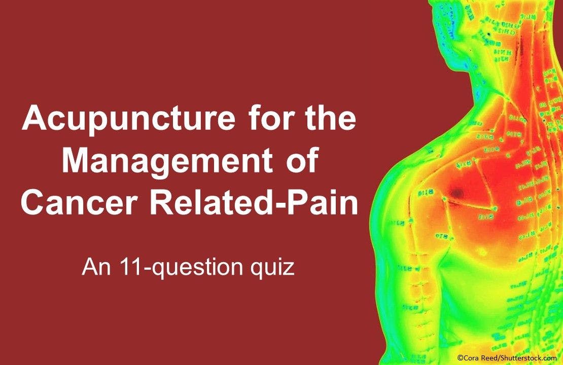 11 Questions on Acupuncture for the Management of Cancer Related-Pain