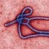  Would you be willing to treat a patient with Ebola?