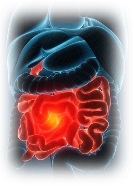 Gastro Pop Quiz: Endoscopic Evaluation in Crohn Disease image credit GI organs ©unlimit3d/stock.adobe.com