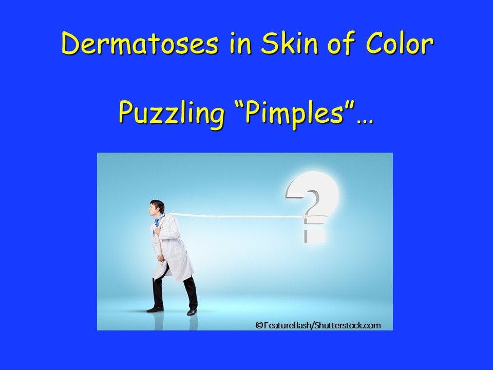 Puzzling "Pimples" in Teens with Skin of Color