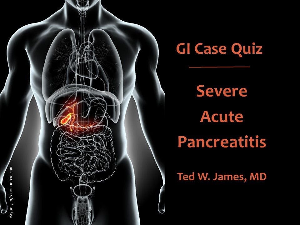 GI Case Quiz: Severe Acute Pancreatitis 